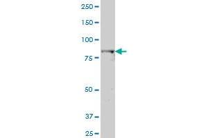 DTX3L polyclonal antibody (A01), Lot # ABNOVA060707QCS1 Western Blot analysis of DTX3L expression in A-431 . (DTX3L 抗体  (AA 3-110))