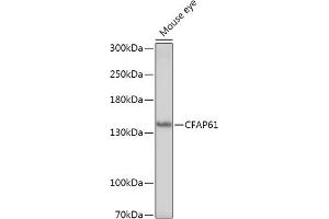 Western blot analysis of extracts of Mouse eye, using CF antibody (ABIN7266399) at 1:1000 dilution. (CFAP61 抗体)