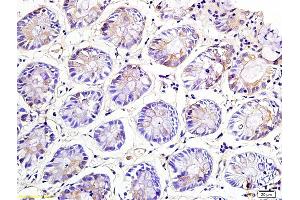 Immunohistochemistry (IHC) image for anti-Killer Cell Lectin-Like Receptor Subfamily C, Member 1 (KLRC1) (AA 8-100) antibody (ABIN739875)