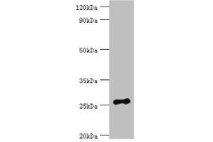 Western blot All lanes: Vesicle-associated membrane protein-associated protein B/C antibody at 3 μg/mL + Mouse brain tissue Secondary Goat polyclonal to rabbit IgG at 1/10000 dilution Predicted band size: 28, 12 kDa Observed band size: 28 kDa (VAPB 抗体  (AA 10-222))