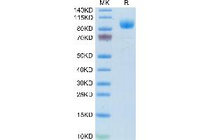 SDS-PAGE (SDS) image for Interferon alpha (IFNA) (AA 27-429) protein (Fc Tag) (ABIN7274852)