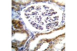 IFT88 antibody immunohistochemistry analysis in formalin fixed and paraffin embedded human kidney tissue. (IFT88 抗体  (AA 791-820))
