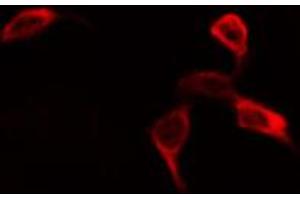 ABIN6268974 staining NIH-3T3 by IF/ICC. (EIF4B 抗体  (pSer422))