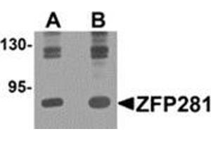 Western blot analysis of ZFP281 in A-20 cell lysate with ZFP281 antibody at (A) 0. (ZNF281 抗体  (C-Term))