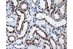 Immunohistochemical staining of paraffin-embedded prostate tissue using anti-SATB1mouse monoclonal antibody. (SATB1 抗体)