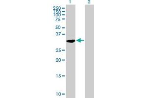Western Blot analysis of C21orf59 expression in transfected 293T cell line by C21orf59 MaxPab polyclonal antibody. (C21orf59 抗体  (AA 1-290))