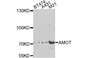 Western blot analysis of extracts of various cell lines, using AMOT antibody (ABIN5975255) at 1/1000 dilution. (Angiomotin 抗体)