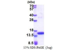 JAK2 Protein (AA 1014-1132) (His tag)