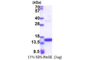 SDS-PAGE (SDS) image for Janus Kinase 2 (JAK2) (AA 1014-1132) protein (His tag) (ABIN5853450) (JAK2 Protein (AA 1014-1132) (His tag))