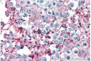 Human Testis (formalin-fixed, paraffin-embedded) stained with BSG antibody ABIN396957 at 10 ug/ml followed by biotinylated anti-mouse IgG secondary antibody ABIN481714, alkaline phosphatase-streptavidin and chromogen. (CD147 抗体)
