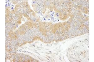 Immunohistochemistry (IHC) image for anti-eIF2 alpha/eif2s1 (C-Term) antibody (ABIN7448959) (eIF2 alpha/eif2s1 (C-Term) 抗体)
