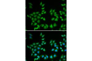 Immunofluorescence analysis of A549 cell using EIF6 antibody. (EIF6 抗体)