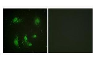 Immunofluorescence analysis of HeLa cells, using Survivin Antibody . (Survivin 抗体)