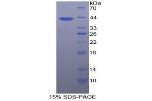 SDS-PAGE analysis of Rat Platelet Factor 4 Protein. (PF4 蛋白)