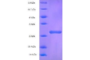 SDS-PAGE (SDS) image for UDP-Gal:betaGlcNAc beta 1,4 Galactosyltransferase, Polypeptide 1 (B4GALT1) (AA 1-24) protein (GST tag) (ABIN5709113)
