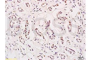 Formalin-fixed and paraffin embedded human kidney tissue labeled with Anti-HES-1 Polyclonal Antibody, Unconjugated (ABIN682393) at 1:200 followed by conjugation to the secondary antibody and DAB staining (HES1 抗体  (AA 41-150))