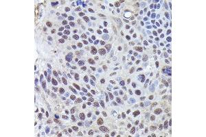 Immunohistochemistry (IHC) image for anti-CGRP Receptor Component (CRCP) (AA 1-115) antibody (ABIN1679351)