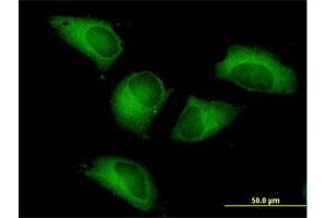 Immunofluorescence of purified MaxPab antibody to PFKP on HeLa cell. (PFKP 抗体  (AA 1-784))