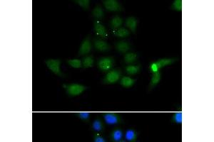 Immunofluorescence analysis of MCF-7 cells using TAT Polyclonal Antibody (Tat 抗体)
