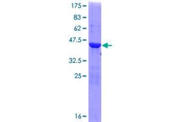 OSBPL1A Protein (AA 1-100) (GST tag)