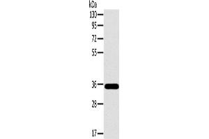 Western Blotting (WB) image for anti-OTU Domain, Ubiquitin Aldehyde Binding 1 (OTUB1) antibody (ABIN2430593) (OTUB1 抗体)