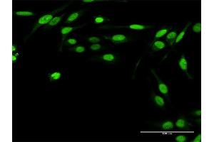 Immunofluorescence of purified MaxPab antibody to TWIST2 on HeLa cell. (TWIST2 抗体  (AA 1-160))