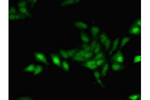 Immunofluorescent analysis of Hela cells using ABIN7153777 at dilution of 1:100 and Alexa Fluor 488-congugated AffiniPure Goat Anti-Rabbit IgG(H+L) (Geminin 抗体  (AA 1-209))