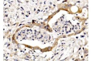IHC analysis of Nectin 3/NECTIN3 using anti-Nectin 3/NECTIN3 antibody (ABIN7602666). (nectin-3 抗体  (AA 92-296))