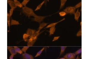 Immunofluorescence analysis of NIH-3T3 cells using UBQLN2 Polyclonal Antibody at dilution of 1:100 (40x lens). (Ubiquilin 2 抗体)