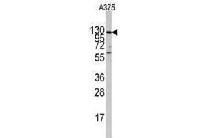 Image no. 2 for anti-Insulin-Degrading Enzyme (IDE) (Center) antibody (ABIN356957) (IDE 抗体  (Center))