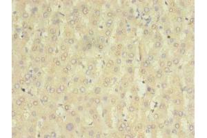 Immunohistochemistry of paraffin-embedded human liver tissue using ABIN7155881 at dilution of 1:100 (HOMER2 抗体  (AA 1-343))