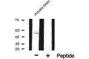 Western blot analysis of Cytochrome P450 17A1 expression in mouse tissue. (CYP17A1 抗体  (Internal Region))