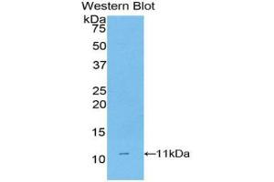 Western blot analysis of the recombinant protein. (CD3D 抗体  (AA 22-106))