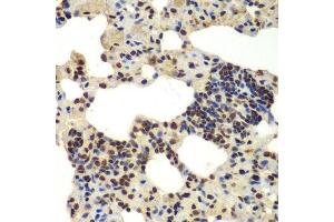 Immunohistochemistry of paraffin-embedded rat lung using DDX5 antibody. (DDX5 抗体  (AA 1-614))