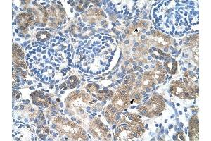 SLC38A4 antibody was used for immunohistochemistry at a concentration of 4-8 ug/ml to stain Epithelial cells of renal tubule (arrows) in Human Kidney. (SLC38A4 抗体  (Middle Region))