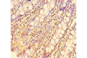 Immunohistochemistry of paraffin-embedded human colon tissue using ABIN7175986 at dilution of 1:100 (ZBTB46 抗体  (AA 174-362))