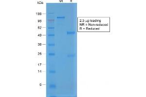 SDS-PAGE Analysis Purified Rabbit Recombinant Monoclonal Antibody (VWF/1859R). (Recombinant VWF 抗体  (AA 1815-1939))