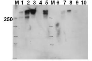 Image no. 1 for anti-Protein Kinase, DNA-Activated, Catalytic Polypeptide (PRKDC) (Thr2609) antibody (ABIN401263) (PRKDC 抗体  (Thr2609))