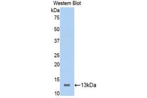 Western Blotting (WB) image for anti-Inducible T-Cell Co-Stimulator (ICOS) (AA 39-133) antibody (ABIN3207896) (ICOS 抗体  (AA 39-133))