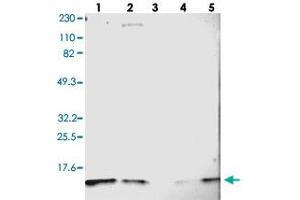 Western blot analysis of Lane 1: RT-4, Lane 2: U-251 MG, Lane 3: Human Plasma, Lane 4: Liver, Lane 5: Tonsil with DYNLT3 polyclonal antibody . (DYNLT3 抗体)