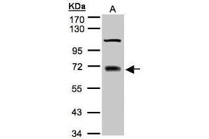 WB Image Sample(30 μg of whole cell lysate) A:A431 7. (TRIM25 抗体)