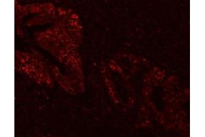 IF analysis of FEN1 using anti-FEN1 antibody (ABIN7601617). (FEN1 抗体  (AA 4-300))