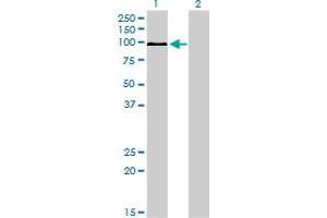 Western Blot analysis of MAPK6 expression in transfected 293T cell line by MAPK6 monoclonal antibody (M01), clone 1G6. (MAPK6 抗体  (AA 612-721))