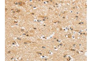 The image on the left is immunohistochemistry of paraffin-embedded Human brain tissue using ABIN7192978(UBTD2 Antibody) at dilution 1/35, on the right is treated with synthetic peptide. (UBTD2 抗体)
