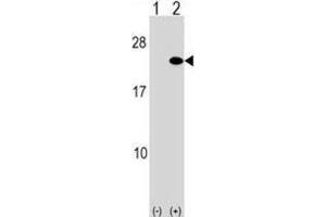 Western Blotting (WB) image for anti-ADP-Ribosylation Factor 5 (ARF5) antibody (ABIN2999205) (ARF5 抗体)