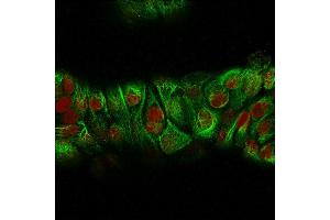 Immunofluorescence Analysis of MeOH-fixed Human MCF-7 cells labeling CK with CK HMW Rabbit Recombinant Monoclonal Antibody (KRTH/2147R) followed by Goat anti-Mouse IgG-CF488 (Green). (Recombinant Cytokeratin 2 抗体)