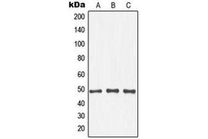 Western blot analysis of IKK beta (pT19) expression in Raw264. (IKBKB 抗体  (N-Term, pSer19))