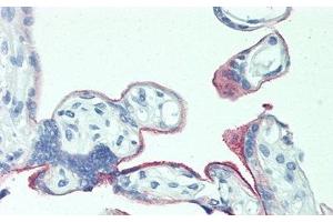 Detection of 0 in Human Placenta Tissue using Polyclonal Antibody to 5T4 (TPBG 抗体  (AA 32-351))