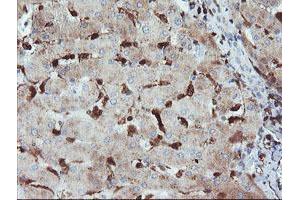Immunohistochemical staining of paraffin-embedded Human liver tissue using anti-GIMAP4 mouse monoclonal antibody. (GIMAP4 抗体)