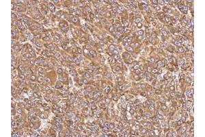 Immunohistochemistry (IHC) image for anti-Acyl-CoA Synthetase Long-Chain Family Member 4 (ACSL4) (C-Term) antibody (ABIN2854678)